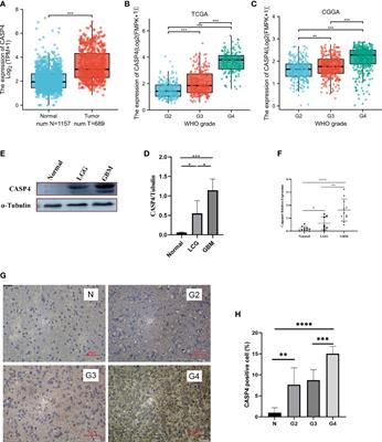 CASP4 can be a diagnostic biomarker and correlated with immune infiltrates in gliomas